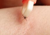 Клещи лютуют: 370 челябинцев обратились к медикам