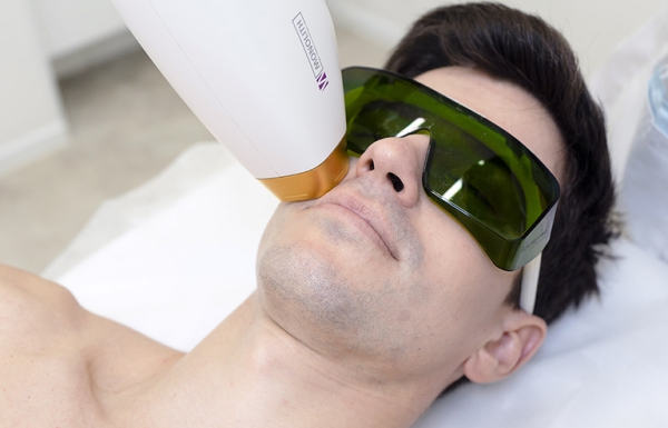 Лазерная эпиляция для мужчин Лазерная эпиляция для мужчин