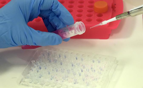 Стало известно, когда в&nbsp;РФ появится экспресс-тест для выявления рака