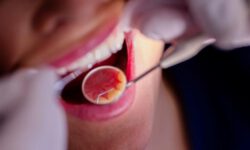 Известная ягода помогает защитить зубы от кариеса