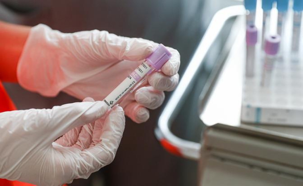 Онколог рассказала, какие анализы могут помочь обнаружить рак Онколог рассказала, какие анализы могут помочь обнаружить рак